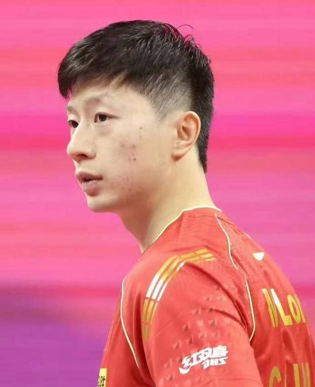 关于马龙在比赛中因伤离场，詹姆斯主教练感到担心的信息